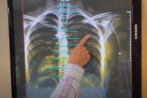 Dr hassel explain x-ray and cause of pain