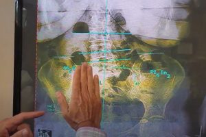 Dr. Hassel explains x-ray results.