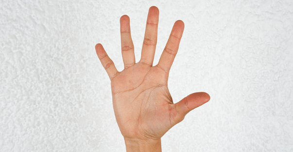 The Five Types of Spondylolisthesis